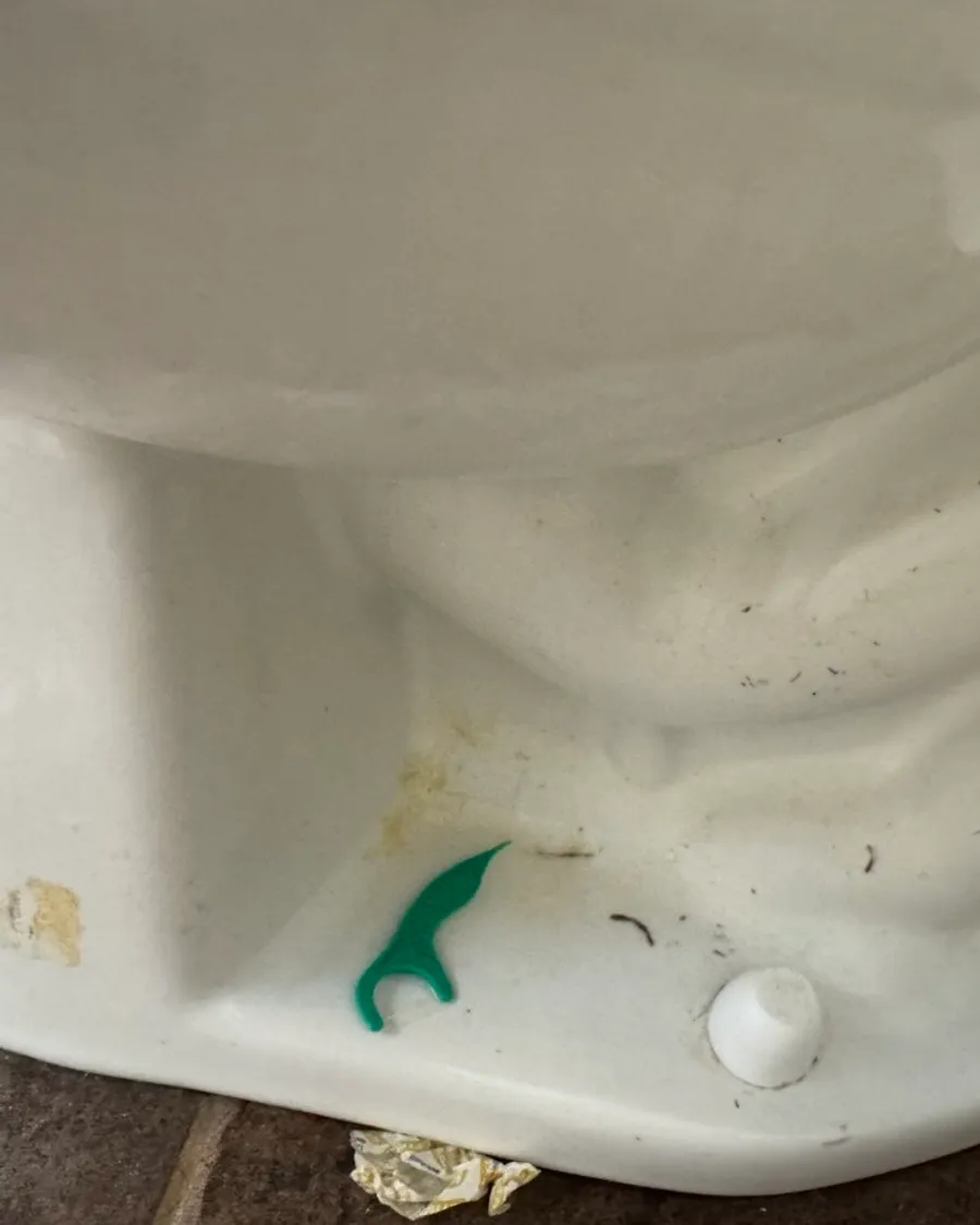 Base of a toilet with yellow stains, dust and a floss pick